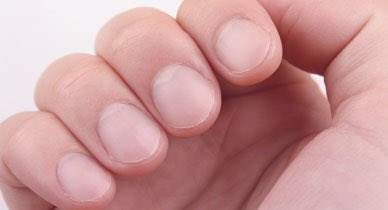 Glomus tumor is a benign growth that occurs in the nail bed